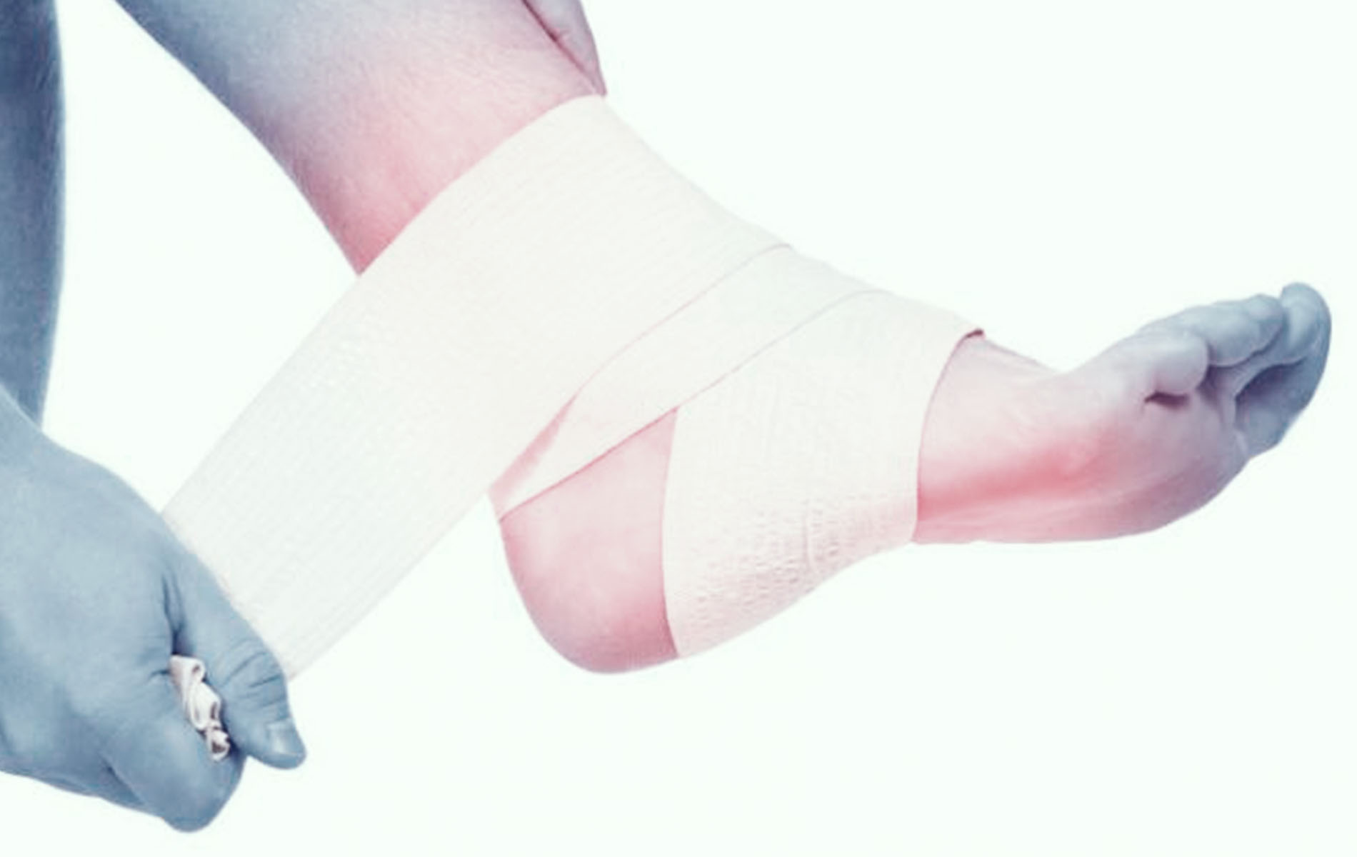 liječenje koksne artroze kučnog zgloba kako izliječiti bol u zglobu stopala