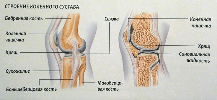 Скопление жидкости в коленном суставе