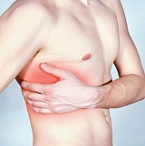 Радикулит грудного отдела позвоночника